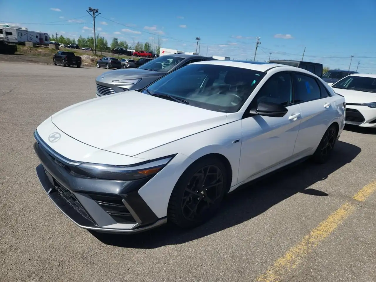 2025 Hyundai ELANTRA Ultimate — photo 1