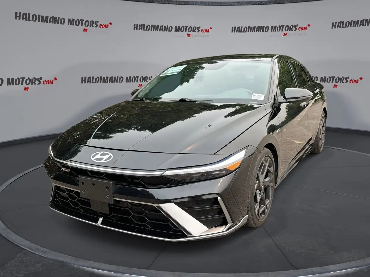2025 Hyundai ELANTRA Ultimate — photo 1